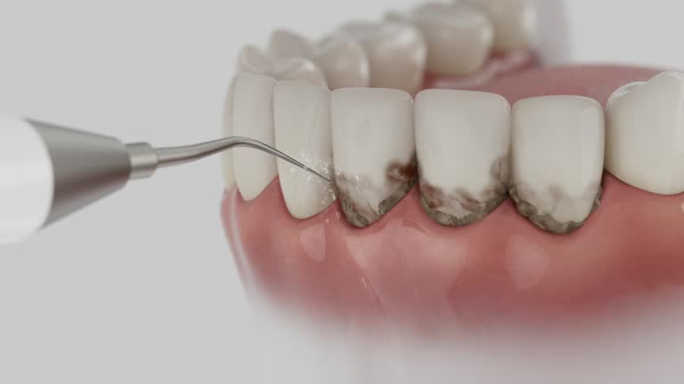 Trusted Dental Crowns And Bridges service in Wilmington, IL - Dentist Open Now